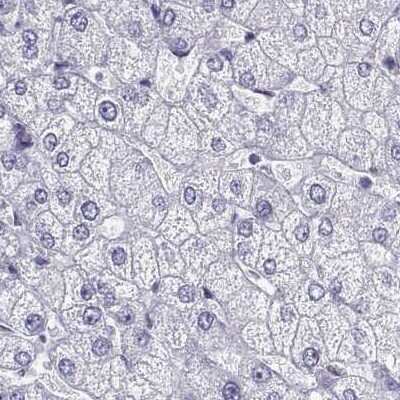 Immunohistochemistry-Paraffin: IGSF1 Antibody [NBP2-14119] - Staining of human liver.