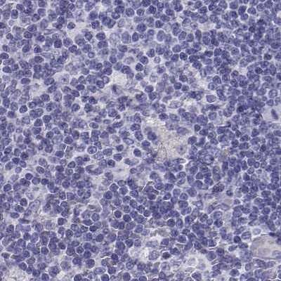 Immunohistochemistry-Paraffin: IGSF1 Antibody [NBP2-14119] - Staining of human lymph node.