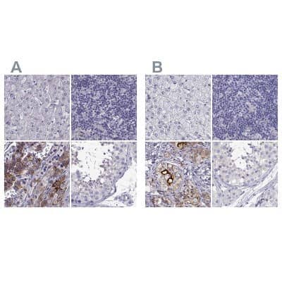 Immunohistochemistry-Paraffin IGSF1 Antibody