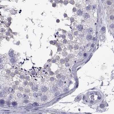 Immunohistochemistry-Paraffin: IGSF1 Antibody [NBP2-68582] - Staining of human testis.