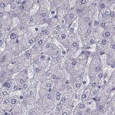 <b>Independent Antibodies Validation. </b>Immunohistochemistry-Paraffin: IGSF1 Antibody [NBP2-68582] - Staining of human liver.