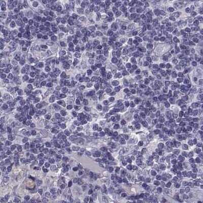 Immunohistochemistry-Paraffin: IGSF1 Antibody [NBP2-68582] - Staining of human lymph node.