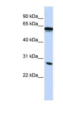 Western Blot: IGSF1 Antibody [NBP1-59108] - HepG2 cell lysate, concentration 0.2-1 ug/ml.