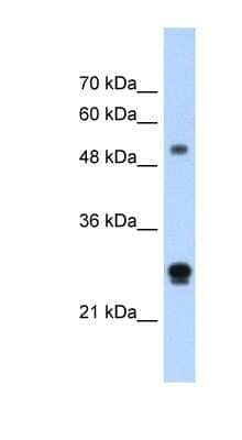 Western Blot IGSF1 Antibody