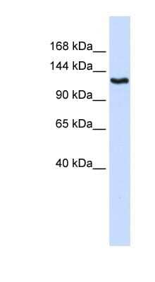 Western Blot: IGSF1 Antibody [NBP1-59245] - 293T cells lysate, concentration 0.2-1 ug/ml.