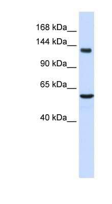 Western Blot: IGSF1 Antibody [NBP1-59246] - Titration: 0.2-1 ug/ml, Positive Control: Human Liver.