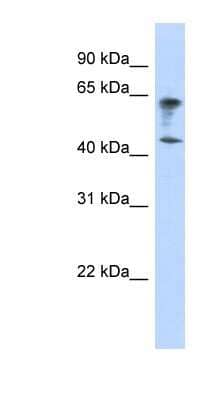 Western Blot: IGSF11 Antibody [NBP1-59503] - Titration: 0.2-1 ug/ml, Positive Control: Transfected 293T.