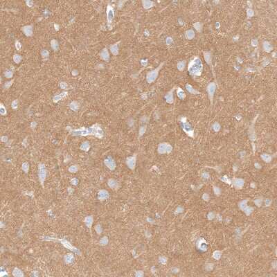 Immunohistochemistry-Paraffin: IGSF21 Antibody [NBP1-81191] - Staining of human cerebral cortex shows moderate positivity in neuropil.