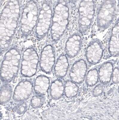 Immunohistochemistry-Paraffin: IGSF21 Antibody [NBP1-81191] - Staining of human colon shows no positivity in glandular cells as expected.