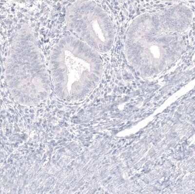 Immunohistochemistry-Paraffin: IGSF21 Antibody [NBP1-81191] - Staining of human endometrium shows no positivity in glandular cells as expected.