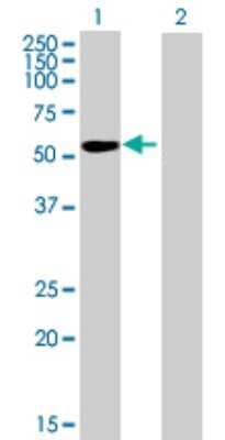 Western Blot: IGSF21 Antibody [H00084966-B01P] - Analysis of IGSF21 expression in transfected 293T cell line by IGSF21 polyclonal antibody.  Lane 1: IGSF21 transfected lysate(51.37 KDa). Lane 2: Non-transfected lysate.