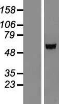 Western Blot: IGSF21 Overexpression Lysate (Adult Normal) [NBL1-11883] Left-Empty vector transfected control cell lysate (HEK293 cell lysate); Right -Over-expression Lysate for IGSF21.