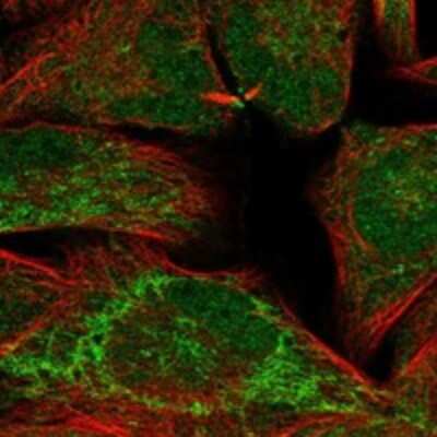 Immunocytochemistry/Immunofluorescence: IGSF22 Antibody [NBP3-17595] - Staining of human cell line RH-30 shows localization to mitochondria.