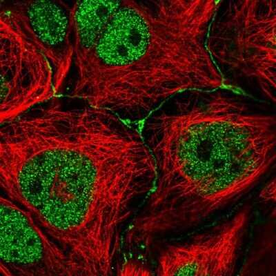 Immunocytochemistry/Immunofluorescence: IGSF23 Antibody [NBP2-33630] - Immunofluorescent staining of human cell line CACO-2 shows localization to nucleus & cell junctions.
