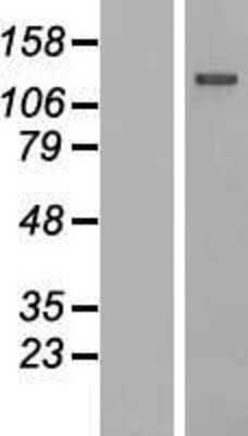 Western Blot: IGSF3 Overexpression Lysate (Adult Normal) [NBP2-08813] Left-Empty vector transfected control cell lysate (HEK293 cell lysate); Right -Over-expression Lysate for IGSF3.