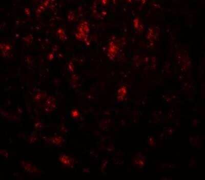 Immunocytochemistry/ Immunofluorescence IGSF4B/SynCAM3/CADM3 Antibody - BSA Free