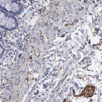 Immunohistochemistry-Paraffin: IGSF4B/SynCAM3/CADM3 Antibody [NBP1-88604] - Staining of human rectum shows strong positivity in peripheral nerve / ganglion.