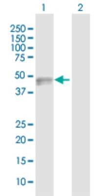 Western Blot: IGSF4B/SynCAM3/CADM3 Antibody [H00057863-D01P] - Analysis of CADM3 expression in transfected 293T cell line by CADM3 polyclonal antibody.Lane 1: CADM3 transfected lysate(43.30 KDa).Lane 2: Non-transfected lysate.