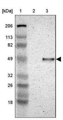 <b>Orthogonal Strategies Validation. </b>Western Blot: IGSF4B/SynCAM3/CADM3 Antibody [NBP1-88604] - Lane 1: Marker  [kDa] 206, 113, 82, 49, 32, 26, 18.   Lane 2: Human cell line RT-4.  Lane 3: Human cell line U-251MG sp