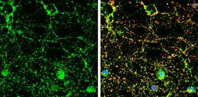 Immunocytochemistry/Immunofluorescence: IGSF4C/SynCAM4 Antibody [NBP3-13192] - IGSF4C/SynCAM4 antibody detects IGSF4C/SynCAM4 protein by immunofluorescent analysis. Sample: DIV9 rat E18 primary cortical neuron cells were fixed in 4% paraformaldehyde at RT for 15 min. Green: IGSF4C/SynCAM4 stained by IGSF4C/SynCAM4 antibody (NBP3-13192) diluted at 1:500. Red: beta Tubulin 3/ Tuj1, stained by beta Tubulin 3/ Tuj1 antibody [GT1338] (NBP3-13505) diluted at 1:500. Blue: Fluoroshield with DAPI.