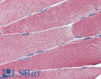 Immunohistochemistry-Paraffin: IGSF4C/SynCAM4 Antibody [NBP1-00164] - Staining of paraffin embedded Human Skeletal Muscle. Steamed antigen retrieval with citrate buffer pH 6, AP-staining.