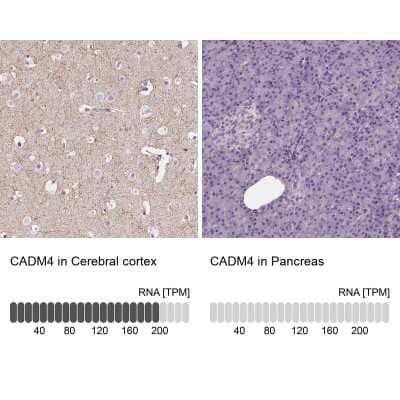 <b>Orthogonal Strategies Validation. </b>Immunohistochemistry-Paraffin: IGSF4C/SynCAM4 Antibody [NBP1-89636] - Staining in human cerebral cortex and pancreas tissues using anti-CADM4 antibody. Corresponding CADM4 RNA-seq data are presented for the same tissues.