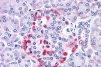 Immunohistochemistry-Paraffin: IGSF4C/SynCAM4 Antibody [NBP3-14360] - Immunohistochemistry of formalin-fixed, paraffin-embedded human pancreas after heat-induced antigen retrieval.