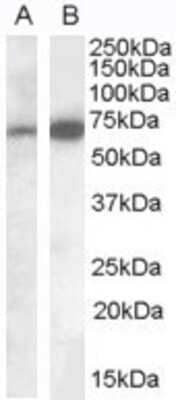 Western Blot: IGSF4C/SynCAM4 Antibody [NB100-93383] - Staining of Human Brain (Cerebellum) 35ug protein in RIPA buffer). A) (0.1ug/ml) and B) (0.05ug/ml). Primary incubation was 1 hour. Detected by chemiluminescence.