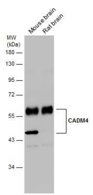 Western Blot: IGSF4C/SynCAM4 Antibody [NBP3-13192] - Various tissue extracts (50 ug) were separated by 10% SDS-PAGE, and the membrane was blotted with IGSF4C/SynCAM4 antibody (NBP3-13192) diluted at 1:1000. The HRP-conjugated anti-rabbit IgG antibody (NBP2-19301) was used to detect the primary antibody.