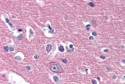 Immunohistochemistry-Paraffin: IGSF4D/SynCAM2/CADM2 Antibody [NBP3-14375] - Immunohistochemistry of formalin-fixed, paraffin-embedded human brain, cortex, after heat-induced antigen retrieval.