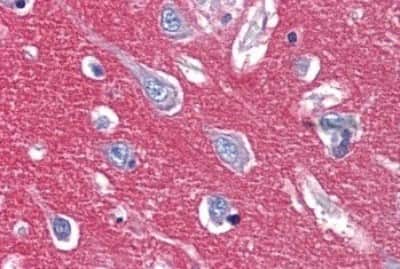 Immunohistochemistry-Paraffin: IGSF4D/SynCAM2/CADM2 Antibody [NBP3-14376] - Immunohistochemistry of formalin-fixed, paraffin-embedded human brain, cortex, after heat-induced antigen retrieval.