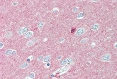 Immunohistochemistry-Paraffin: IGSF4D/SynCAM2/CADM2 Antibody [NBP3-14377] - Immunohistochemistry of formalin-fixed, paraffin-embedded human brain, cortex, after heat-induced antigen retrieval.