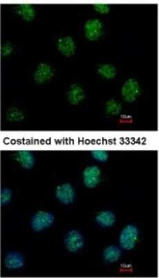 Immunocytochemistry/Immunofluorescence: IHPK2 Antibody [NBP1-32322] - Analysis of methanol-fixed H1299, using antibody at 1:500 dilution.