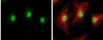 Immunocytochemistry/Immunofluorescence: IHPK2 Antibody [NBP1-32322] - HeLa cells were fixed in 4% paraformaldehyde at RT for 15 min. Green: IP6K2 protein stained by IP6K2 antibody diluted at 1:500. Red: alpha Tubulin, a cytoskeleton marker, stained by alpha Tubulin antibody [114] diluted at 1:1000.