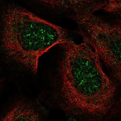 Immunocytochemistry/Immunofluorescence: IHPK2 Antibody [NBP2-68909] - Staining of human cell line U-2 OS shows localization to nucleoli fibrillar center.