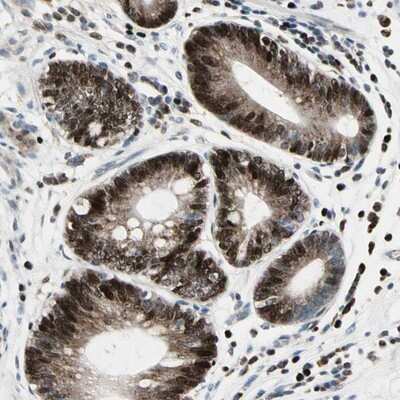 Immunohistochemistry-Paraffin: IHPK2 Antibody [NBP1-89635] - Staining of human stomach shows strong nuclear and cytoplasmic positivity in glandular cells.
