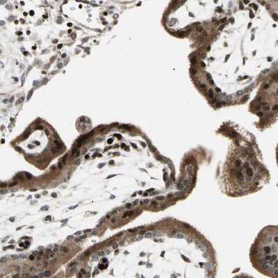 Immunohistochemistry-Paraffin: IHPK2 Antibody [NBP1-89635] - Staining of human placenta shows strong nuclear positivity in trophoblastic cells.