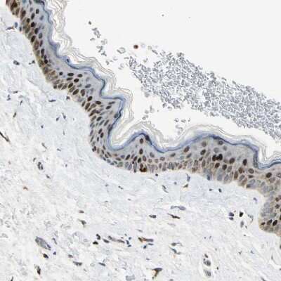 Immunohistochemistry-Paraffin: IHPK2 Antibody [NBP1-89635] - Staining of human skin shows moderate to strong nuclear positivity in keratinocytes.