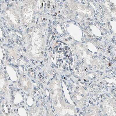 Immunohistochemistry-Paraffin: IHPK2 Antibody [NBP1-89635] - Staining of human kidney shows moderate nuclear positivity in cells in glomeruli.