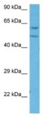 Western Blot: IHPK2 Antibody [NBP3-10132] - Western blot analysis of IHPK2 in Mouse SP2/0 Whole Cell lysates. Antibody dilution at 1ug/ml