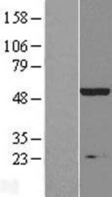 Western Blot: IHPK2 Overexpression Lysate (Adult Normal) [NBP2-11188] Left-Empty vector transfected control cell lysate (HEK293 cell lysate); Right -Over-expression Lysate for IHPK2.