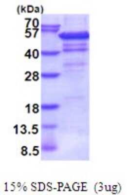 SDS-Page: IHPK2 Recombinant Protein [NBP2-51982] - 15% SDS Page (3 ug)