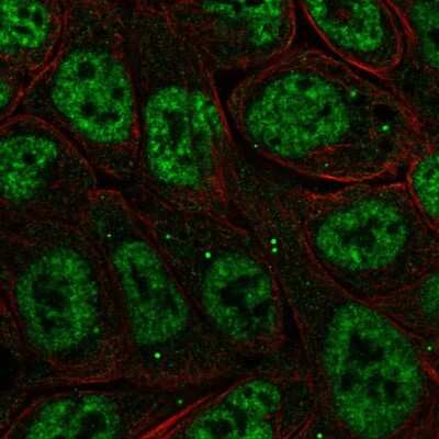 Immunocytochemistry/Immunofluorescence: IKB zeta Antibody [NBP2-57948] - Staining of human cell line RT4 shows localization to nuclear speckles & cytoplasmic bodies.