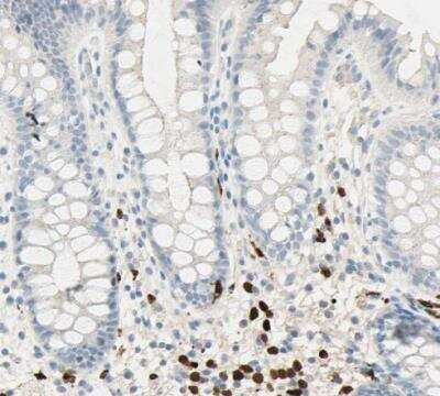 Immunohistochemistry-Paraffin: IKB zeta Antibody [NBP1-89835] - Staining of human recctum shows strong nuclear positivity in lymphoid cells.