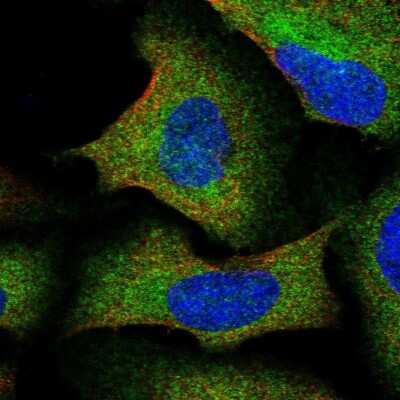 Immunocytochemistry/Immunofluorescence: IKBKAP Antibody [NBP2-56082] - Staining of human cell line U-2 OS shows localization to cytosol.