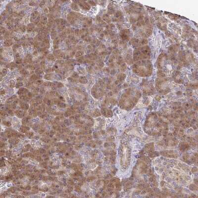 Immunohistochemistry: IKBKAP Antibody [NBP2-48973] - Staining of human pancreas shows moderate cytoplasmic and nuclear positivity in exocrine glandular cells.