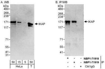 Western Blot: IKBKAP Antibody [NBP1-71918] - Whole cell lysate from HeLa (5, 15 and 50 mcg for WB; 1 mg for IP, 20% of IP loaded) and 293T (T; 50 mcg) cells.   Affinity purified rabbit anti-IKAP antibody used for WB at 0.1 mcg/ml (A) and 1 mcg/ml (B) and used for IP at 6 mcg/mg lysate.  IKAP was also immunoprecipitated by rabbit anti-IKAP antibody NBP1-71919, which recognizes a downstream epitope.