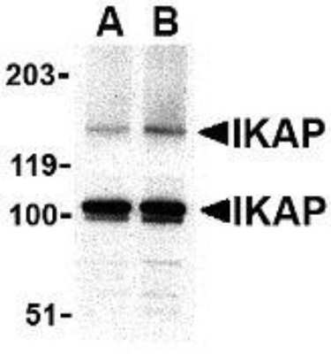 Western Blot: IKBKAP Antibody [NBP1-76788] - A-20 cell lysate with IKBKAP antibody at in (A) 0.5, and (B) 1 u/mL.