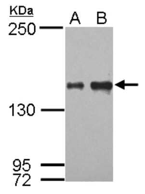 Western Blot: IKBKAP Antibody [NBP2-16936] - Sample (30 ug of whole cell lysate) A: HeLa B: HepG2 5% SDS PAGE gel, diluted at 1:1000.