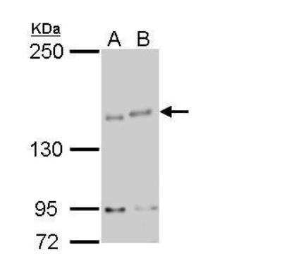 Western Blot: IKBKAP Antibody [NBP2-16936] - A. 30 ug GL261 whole cell lysate/extract  B. 30 ug Raw264.7 whole cell lysate/extract 5% SDS-PAGE IKAP antibody [C1C2], Internal dilution: 1:500  The HRP-conjugated anti-rabbit IgG antibody (NBP2-19301) was used to detect the primary antibody.